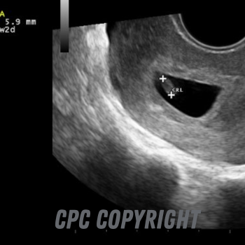 30 days from conception/6 weeks from your last period