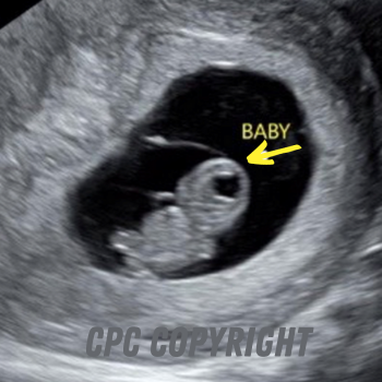 6 weeks after conception